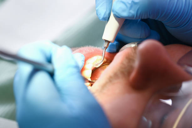 Best Emergency Treatment for Toothache in Duluth, GA